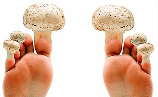 fungo nas uñas