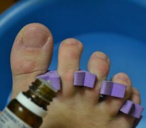 Preparándose para tratar as uñas con gotas antifúngicas